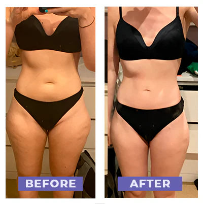 Say goodbye to cellulite, this heated cupping massager effortlessly tones and firms your skin.